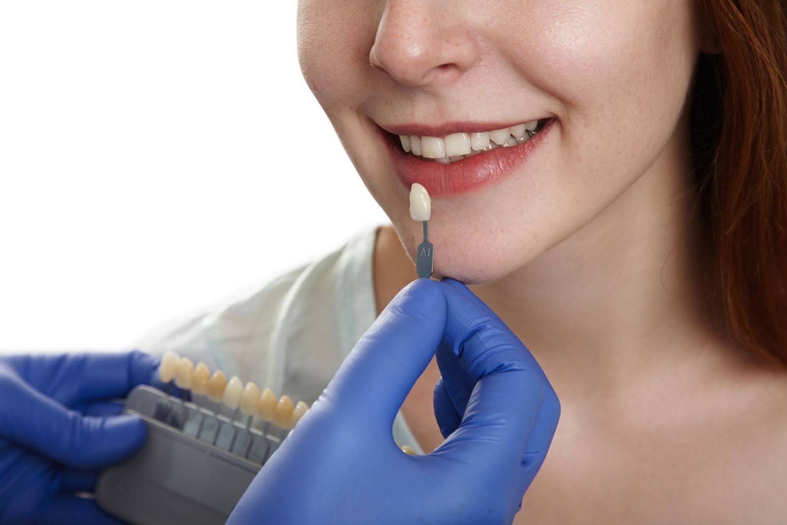 Dental Crowns Explained | Smiling Molar Dental